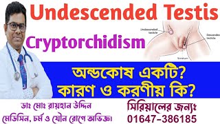 Undescended testis || Cryptorchidism || অন্ডকোষ একটি? অন্ডকোষ একটি কেন হয়?করণীয় কি? Dr.Rayhan Uddin.