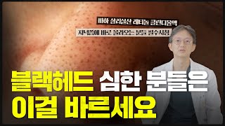 블랙헤드 해결방법 고민이라면 봐야하는 영상(관리방법, 치료방법 공유)