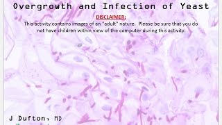 Candidiasis: Overgrowth and Infection of Yeast