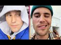 Justin Bieber Shows Off Facial Paralysis Recovery Progress