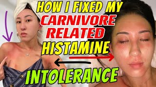 How to fix histamine intolerance | Carnivore Foods to AVOID high in histamines | autoimmune tips