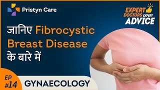 Fibrocystic Breast Disease in Hindi