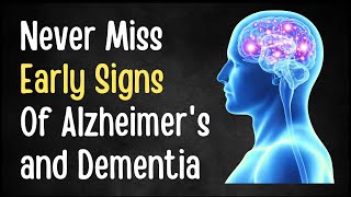 99% of People Ignore This Alzheimer’s Warning Signs—Do You?