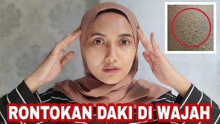 Cara Cepat Rontokan Daki di Wajah - Auto Kinclong