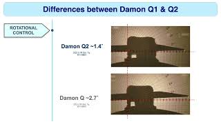 Differences between Damon Q1 \u0026 Q2 Features Overview｜【Chris Chang Ortho】CC679