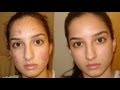 A true miracle- How I got rid of my acne. Daily skin-care routine. A true miracle- How I got rid of my acne. Daily skin-care routine.