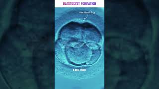 Real footage of Blastocyst Formation under microscope | Human Embryo Development Stages #blastocyst