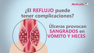 COMPLICACIONES DEL REFLUJO