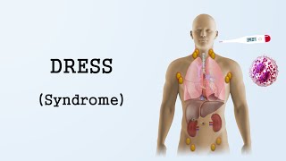 DRESS Syndrome (Drug Reaction with Eosinophilia and Systemic Symptoms)