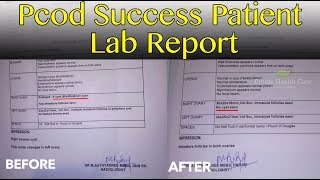 PCOD | PCOS | Vima Successful Patient Lab Reports And Review | Ethnic Health Care | Dr.B.Yoga Vidhya