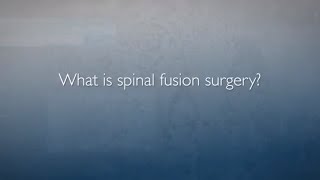 Approaches to Spinal Fusion | FAQ's