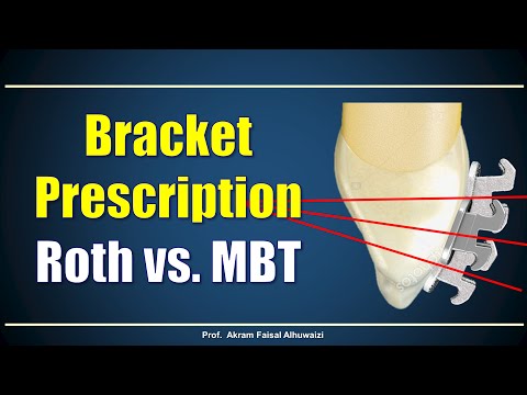 Use of Roth and MBT braces