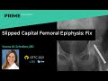 Slipped Capital Femoral Epiphysis: Fix - Verena M. Schreiber, MD