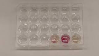 10  The NItrate test and the TSI Slant