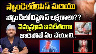 వెన్నుపూస విపరీతంగా జారిపోతే ఏం చేయాలి?? DR.Arjun About Spondylolysis And Spinal problems