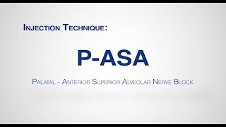Module: P-ASA Injection