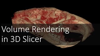 Volume Rendering in 3D Slicer | Introduction to Digital Preparation Video 9