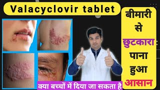 नहीं सहनी पड़ेगी! यह दर्दनाक बीमारी | Valcivir 1000 mg tablet uses in hindi