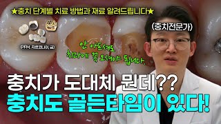 충치가 도대체 뭔데?? 충치도 골든 타임이 있다! feat.안아파도 치과 가야되는 이유