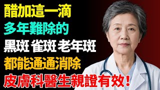 震驚！醋加這一滴，多年難除的，黑斑雀斑老年斑，都能通通消除！皮膚科醫生親證有效！【健康養生坊】#老年斑#壽命#健康飲食#飲食禁忌#養老 #退休生活 #晚年健康#養生