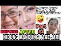 TIPS HIDUNG MANCUNG VIRAL TANPA OPERASI | SHARP NOSE