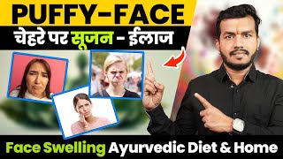 352#Puffy Face (चेहरे पर सूजन) Kyu Hoti H Aur Uska Best Ilaaj||Face swelling Ayurvedic Diet \u0026 Home