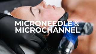 Microneedling + Microchanneling Facial Fundamentals