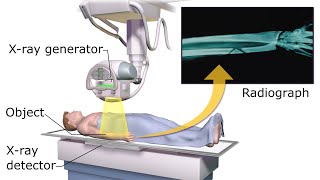 how x-ray machine works || كيف تعمل آلة الأشعة السينية