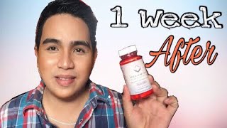 RELUMINS GLUTA-1000 REVIEW AFTER 1 WEEK | Edrian Sasutil