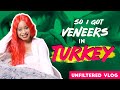 So I got Veneers in Turkey (VLOG)