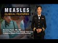 Measles Clinical Features