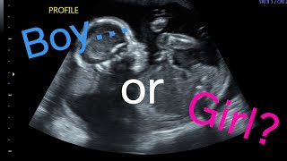 BOY or GIRL??? Gender Reveal!