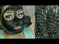 Easy DIY Blackhead Remover Peel Off Mask REMOVES EVERYTHING | BeautyByJosieK Easy DIY Blackhead Remover Peel Off Mask REMOVES EVERYTHING | BeautyByJosieK