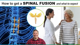Spine surgeon explains: What to Expect with spine fusion, low back pain, spondylolisthesis, stenosis