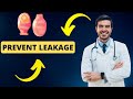 How to prevent ostomy leakage ? Avoid bag leaks