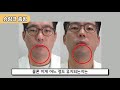 슈링크 제가 직접 맞아봤습니다 별로 안아픈데요