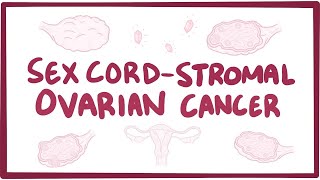 Sex cord-stromal ovarian cancer - an Osmosis Preview