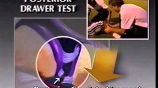 Masters of Sports Medicine - Athletic Injuries of The Knee - Part 1 (Circa 1992)