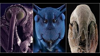 Wonderful Electron Microscope Images