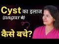 🤒क्या Cyst का इलाज है? Identify and Cure Cyst (WITHOUT SURGERY)