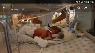 PREMATURE BABY  (our story) 29 weeks to 10 months(video and pictures