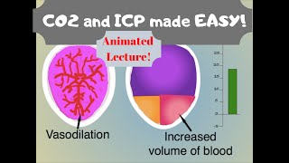 Carbon Dioxide \u0026 Intracranial Pressure (ICP): Effects of CO2 on blood vessels.