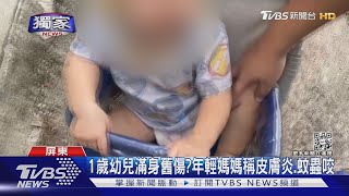 #獨家 23歲母求救兩童無奶粉 赫見男童大腿疑瘀青舊傷｜TVBS新聞