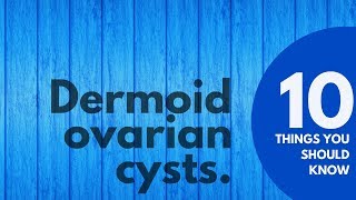 10 Things You SHOULD KNOW About Dermoid Ovarian Cysts | Prevent & Treat Ovarian Cysts Naturally