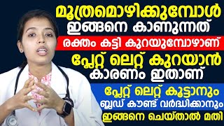 മൂത്രമൊഴിക്കുമ്പോൾ ഇങ്ങനെ കാണുന്നത് ശ്രദ്ധിക്കണം | പ്ലേറ്റലേറ്റ് കൂടാനും കൗണ്ട് വർധിക്കാനും