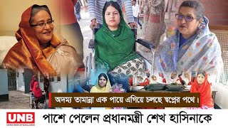 মাত্র একটি পা নিয়ে জন্ম তামান্নার। হাত দুটোও নেই। তবু থেমে নেই সে | UNB