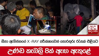 සීතා ඇතිත්නගේ X -RAY පරීක්ෂාවෙන් තොරතුරු රැසක් එළියට... උණ්ඩ කැබලි 8ක් ඇඟ ඇතුළේ