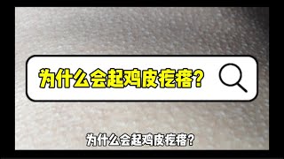 十万个为什么【身体篇】为什么会起鸡皮疙瘩？