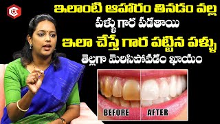 పళ్ళు తెల్లగా మారాలంటే | Natural Ways to Whiten Teeth at Home Telugu | Worst Foods For Your Teeth