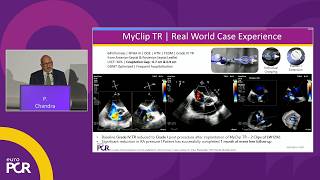 Beyond the horizon - Future of structural heart innovations and PCI - EuroPCR 2026
